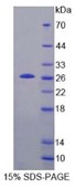 SDS-PAGE (Tpt1-615M).jpg